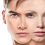 Surgery for gender identity disorder